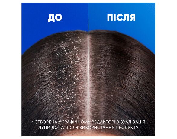 Шампунь для волосся Head&Shoulders Основний догляд 400 мл Аврора картинка 2 з доставкою